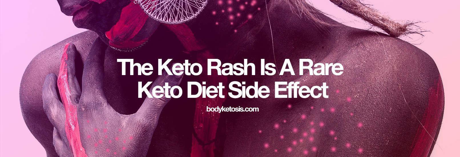 the keto rash